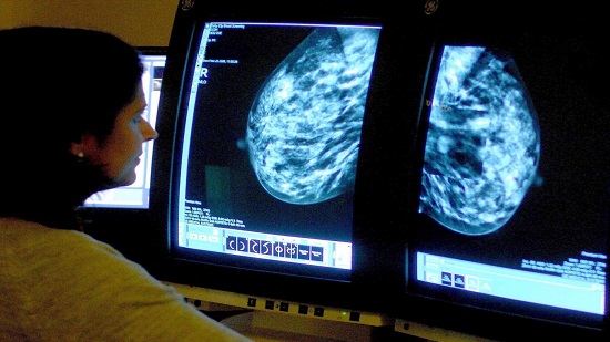 Breast cancer treatment 'holy grail' within reach after breakthrough, scientists claim
