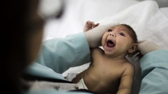 World must ready for global microcephaly ‘epidemic’, study