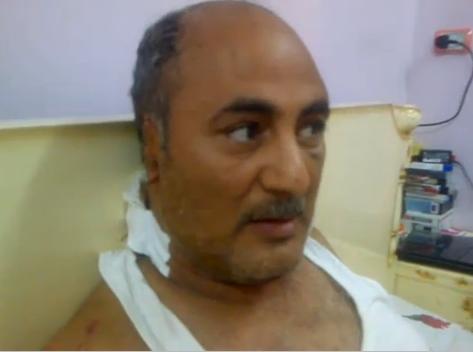 Muslims Attack Christian in Egypt, Cut Off His Ear
