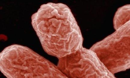 E. coli outbreak: Europe-wide controls 'not needed'
