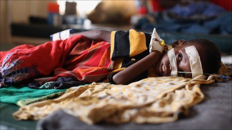 UN declares Somalia famine in Bakool and Lower Shabelle
