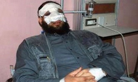 Nose job ends Salafist MP's political career
