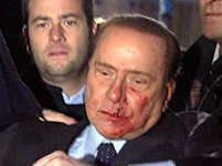 Italian Prime Minister Berlusconi in hospital after punch at rally