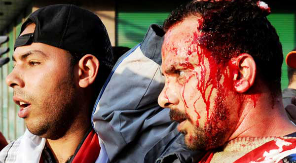 6 killed, over 800 injured in Tahrir clashes, says Ministry of Health	